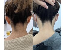 ミース 長野店/うなじ矯正◆ビフォーアフター