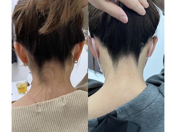 ミース 長野店/うなじ矯正◆ビフォーアフター