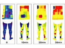 アクア エステティコ 亀有(ACQUA estetico)の雰囲気(ラジオ波による《温活》を!深部温度が上がり太りにくい体に◎)
