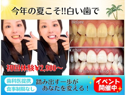ホワイトニングショップ 多摩店の写真