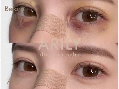 アリリィ(ARILY)の写真