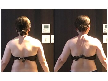 ソレイユ/インディバ90分