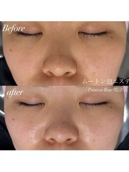 プリンセスローズ 焼津店(Princess Rose)/ムートン泡エステ