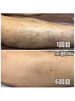 メンズ シンバ(SIMBA)/