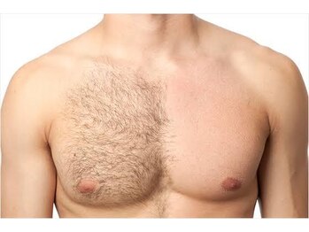 グルーミー(gloomy)/夏にオススメ★SET MENU