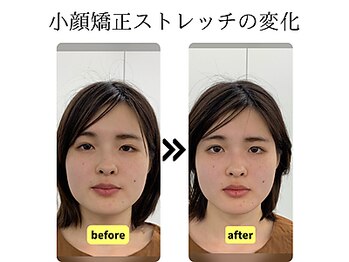 ストレッチヒーロー 岡山問屋町店/フェイスラインすっきり！