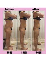 ビューティーショップ リアン(RIAN)/全身ダイエット