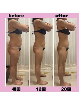 ビューティーショップ リアン(RIAN)/全身ダイエット