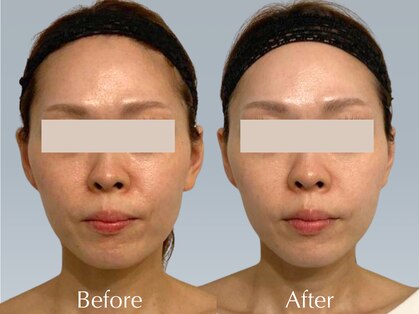 バウムユー 銀座店(baum.u)の写真