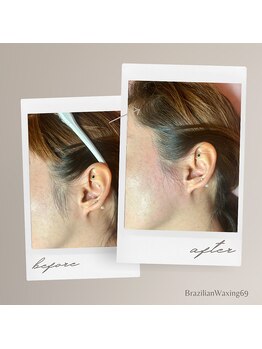 ブラジリアンワキシング シックスナイン(BrazilianWaxing69)/女性 / もみあげ