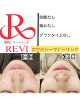 ラルーナ(La Luna)/ハーブピーリング★