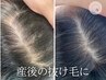 【生え際・分け目・後頭部】育毛促進コース◇¥38000