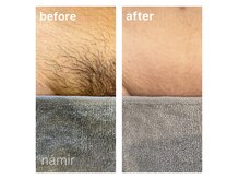 脱毛サロンnamir札幌店【ブラジリアンワックス/美容脱毛/眉毛】~メンズ/レディース~の雰囲気(【#VIOブラジリアンワックス】札幌最安値!VIOワックス¥4980)