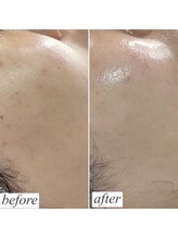 ロイヤル ビューティー サロン(Royal Beauty Saloon)/韓国発最新肌管理【セルマン】