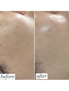 ロイヤル ビューティー サロン(Royal Beauty Saloon)/韓国発最新肌管理【セルマン】