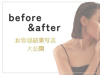 ジュリアン 千葉店(Julien)/before＆after