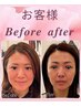 【人気No2/小顔Vライン】ナノカレント(60分)×ホワイトスノーピール￥29700→
