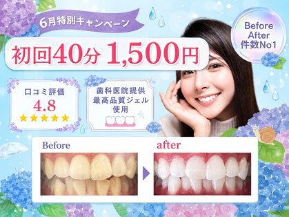 ホワイトニングショップ 福岡春日店の写真