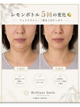 ブリリアントスマイル/たるみ二重顎にはレモンボトル