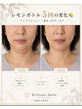ブリリアントスマイル/たるみ二重顎にはレモンボトル
