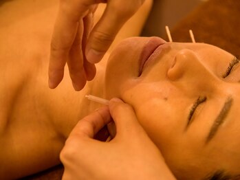 ジネコラボ 横浜山下町(Gyneco-labo)の写真/【夏のUV対策】美顔鍼で肌質改善&効かせるリンパで首肩スッキリ♪浮腫対策やエイジングケアにも◎
