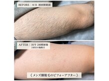 ディアーアンド 薬院(Dear&)の雰囲気（早い段階で目に見えて効果を感じていただけます♪）