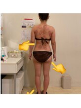 モカ(MOKA)/毒汗デトックス