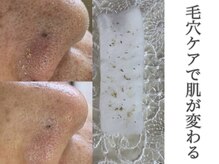 リッカロッカ(RIKKA&ROCCA)/衝撃と感動のBefore・After