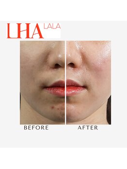 アリミリサロン(A.Rimi.Ri salon)/韓国発☆ララピール☆