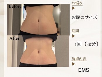 ベレガ 京都店(BELEGA)/◆BeforeAfter◆