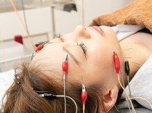 うかい鍼灸整体院の雰囲気（「嘘を付かない美容鍼」として大人気メニューです！）