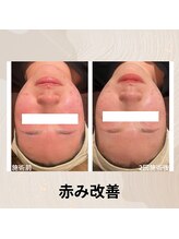 チェンジ(Change)/