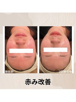 チェンジ(Change)/