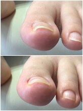 モアクリスタル(More Crystal)/