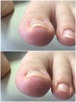 モアクリスタル(More Crystal)/