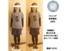 RKY/全身の歪み解消