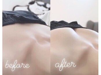 エムプリュ 心斎橋店(M.plus)/バストアップコース1回目