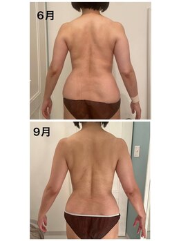 美人バスト 渋谷店/【痩身・ダイエット】渋谷/お腹