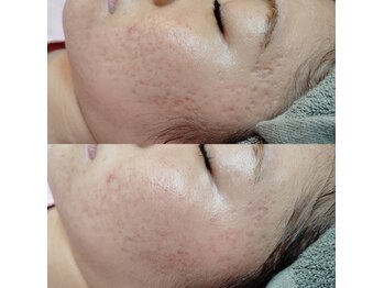 ワンネス(oneness)