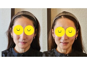 金梨花サロン/面長顔の改善!