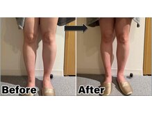 ポノ インディバ サロン(pono. Indiba salon)/美脚♪