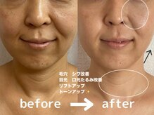 リラクゼーションエステ アジュール(Azur)/【施術12回】