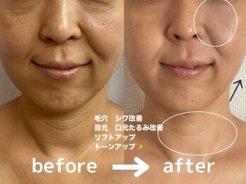 リラクゼーションエステ アジュール(Azur)/【施術12回】