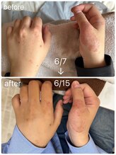 ヨサパーク シピ(YOSAOARK Chipie)/水素水の効果