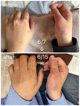 ヨサパーク シピ(YOSAOARK Chipie)/水素水の効果