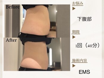 ベレガ 京都店(BELEGA)/◆BeforeAfter◆