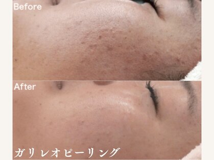 ティアラ(TIARA)の写真