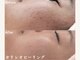 ティアラ(TIARA)の写真