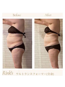 リンクス(Rink's)/before→after