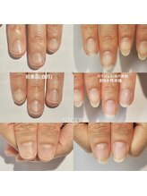 ニコプラス(NICO+)/自爪育成中